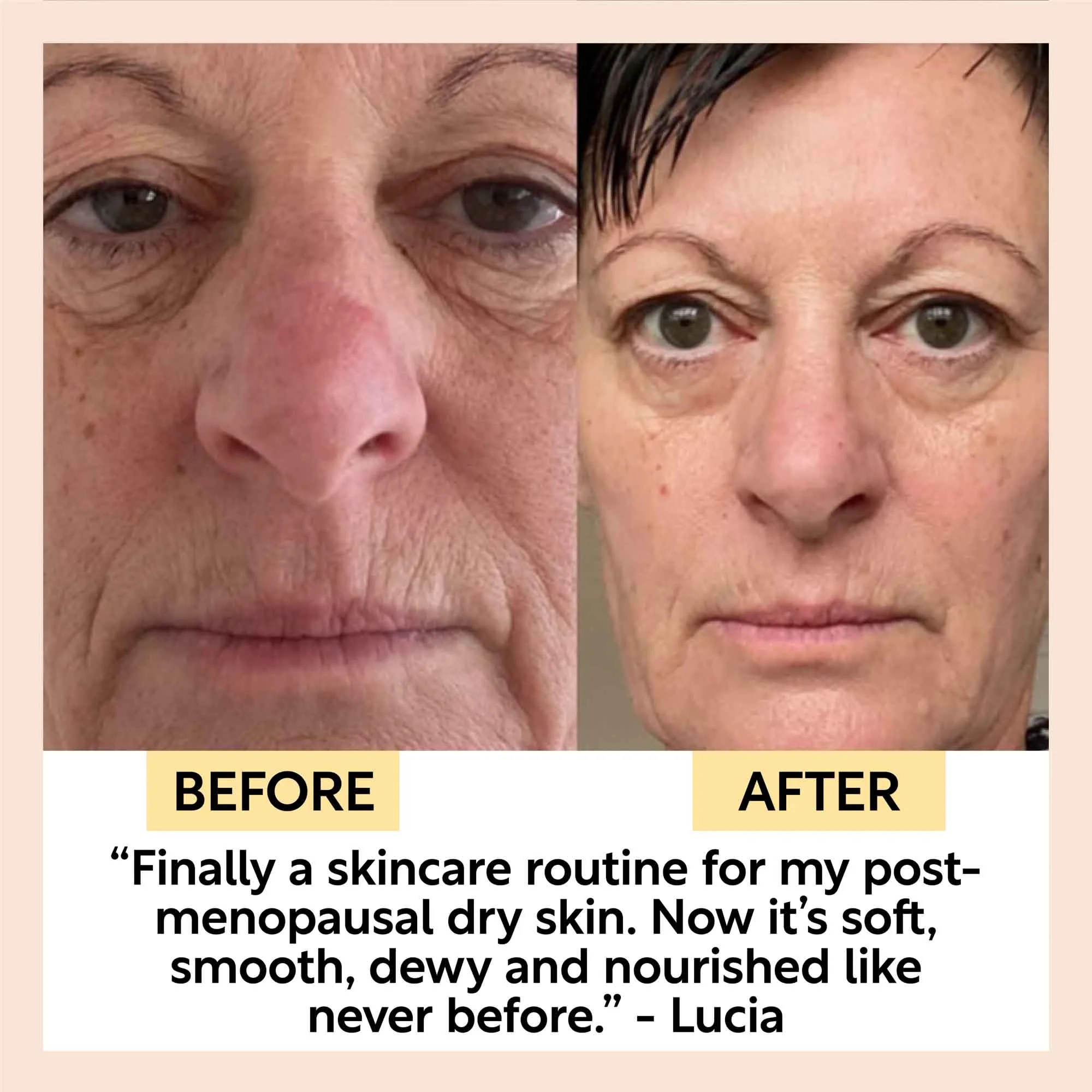 Eye Cream with Hyaluronic Acid & Coffee - Image 10