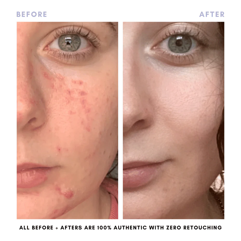 The Balanced Skin Set (Travel-Size) - Image 7