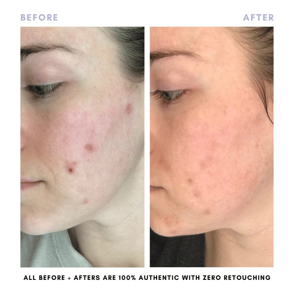 The Skin Reset Starter Kit - Image 15